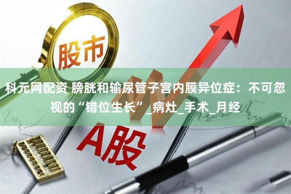 科元网配资 膀胱和输尿管子宫内膜异位症：不可忽视的“错位生长”_病灶_手术_月经